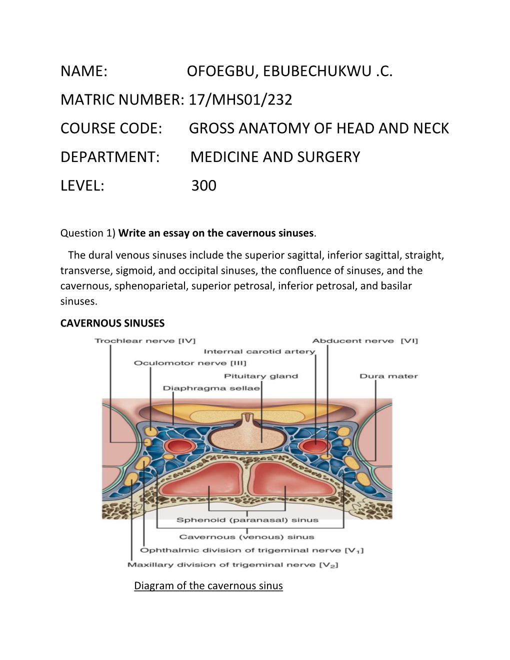 Name: Ofoegbu, Ebubechukwu .C. Matric Number: 17/Mhs01/232 Course Code: Gross Anatomy of Head and Neck Department: Medicine and Surgery Level: 300