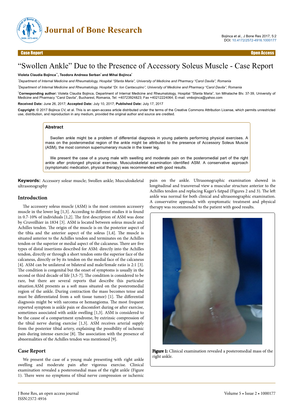 “Swollen Ankle” Due to the Presence Of
