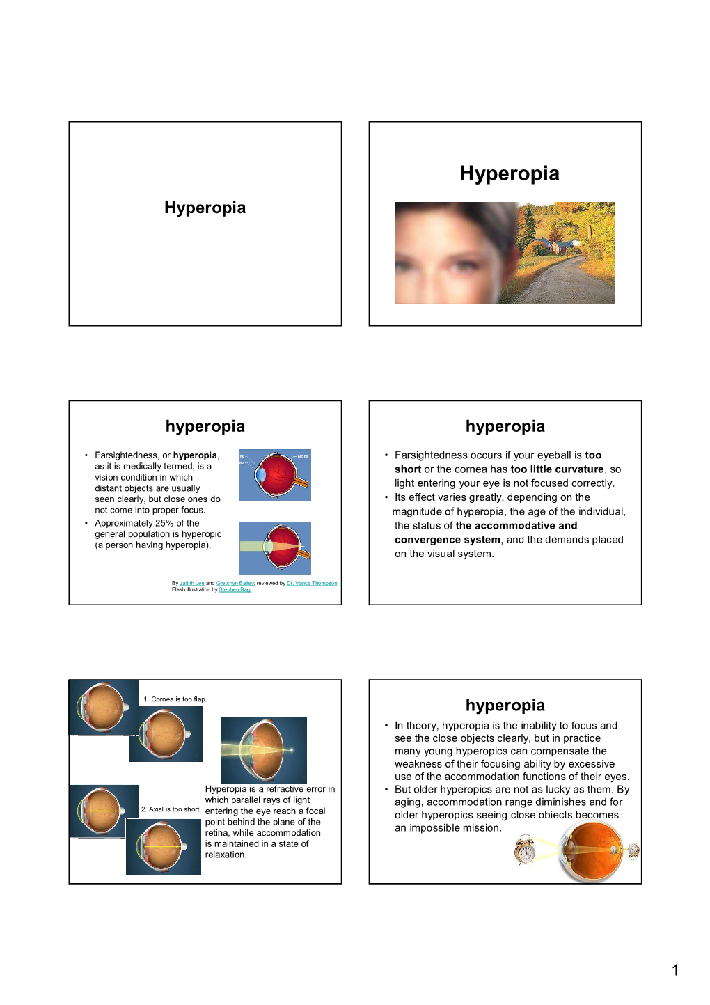 Hyperopia Hyperopia