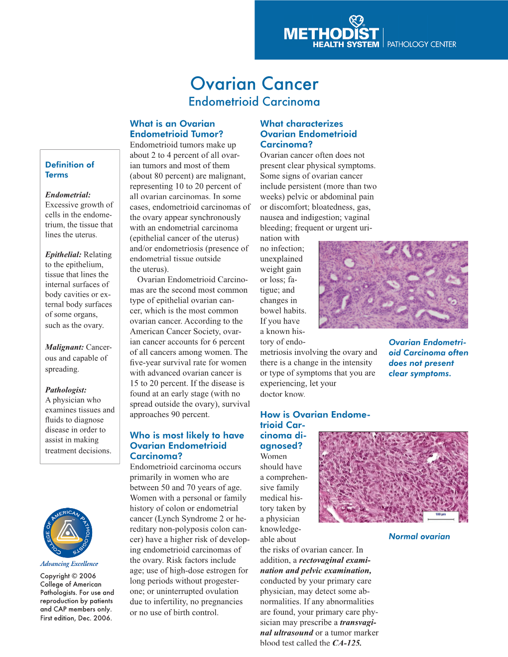 Endometrioid Carcinoma