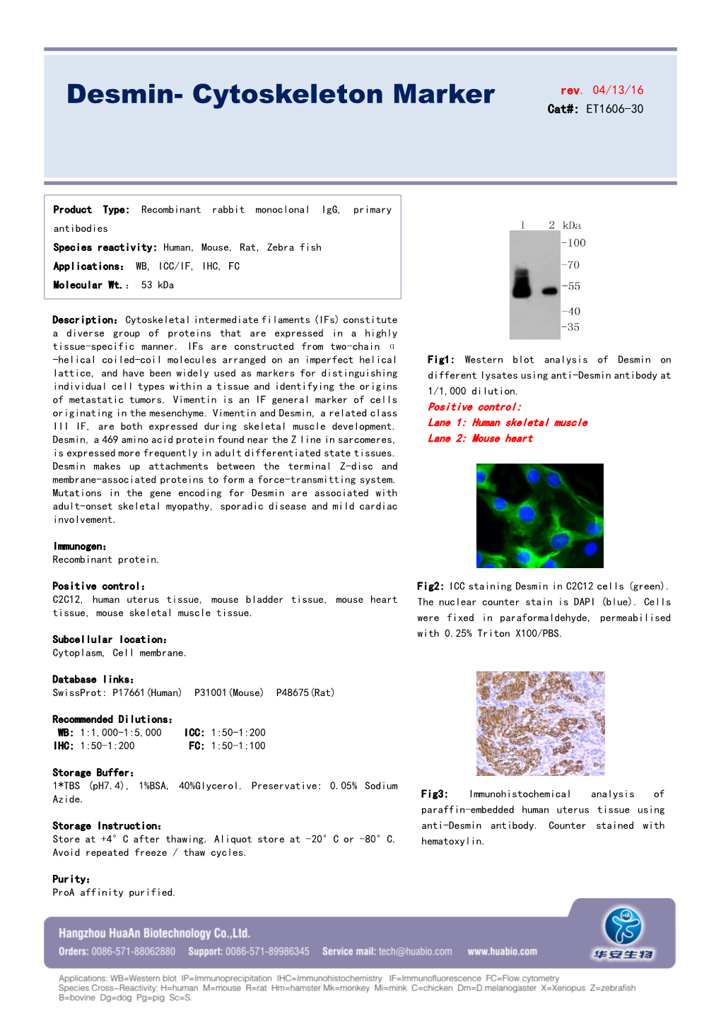 Desmin- Cytoskeleton Marker Cat#: ET1606-30