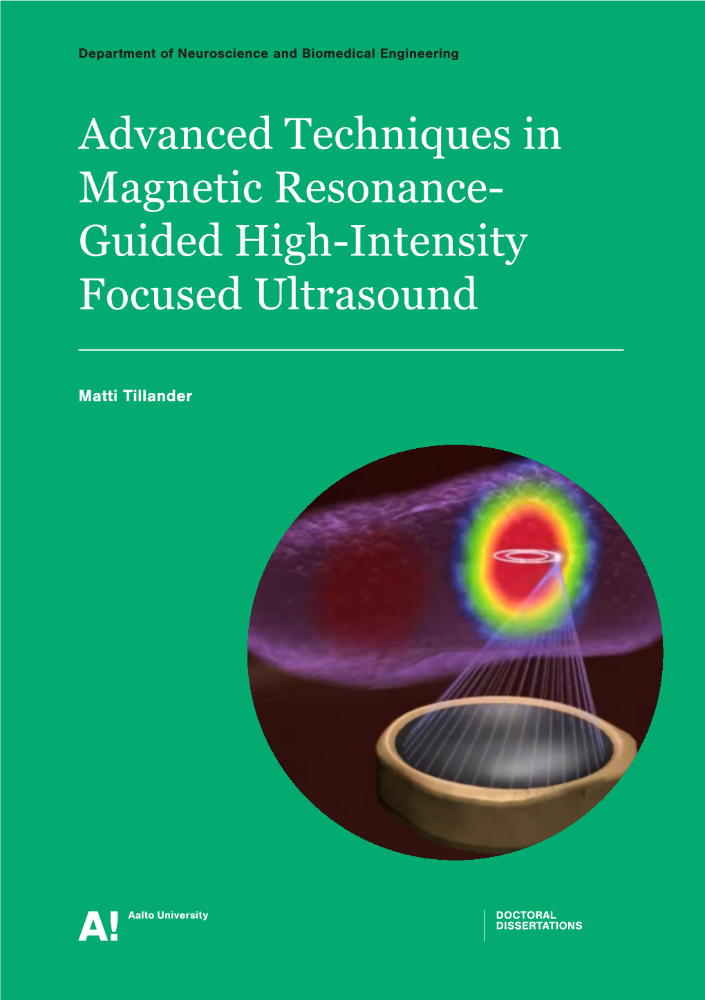 2. High-Intensity Focused Ultrasound 17 2.1 Ultrasound in Medicine