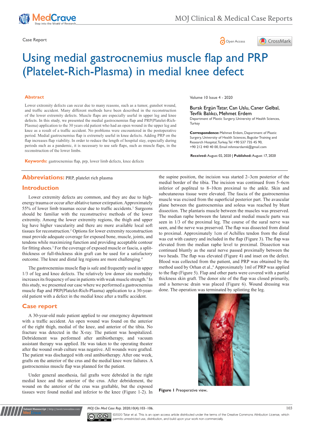 Using Medial Gastrocnemius Muscle Flap and PRP (Platelet-Rich-Plasma) in Medial Knee Defect