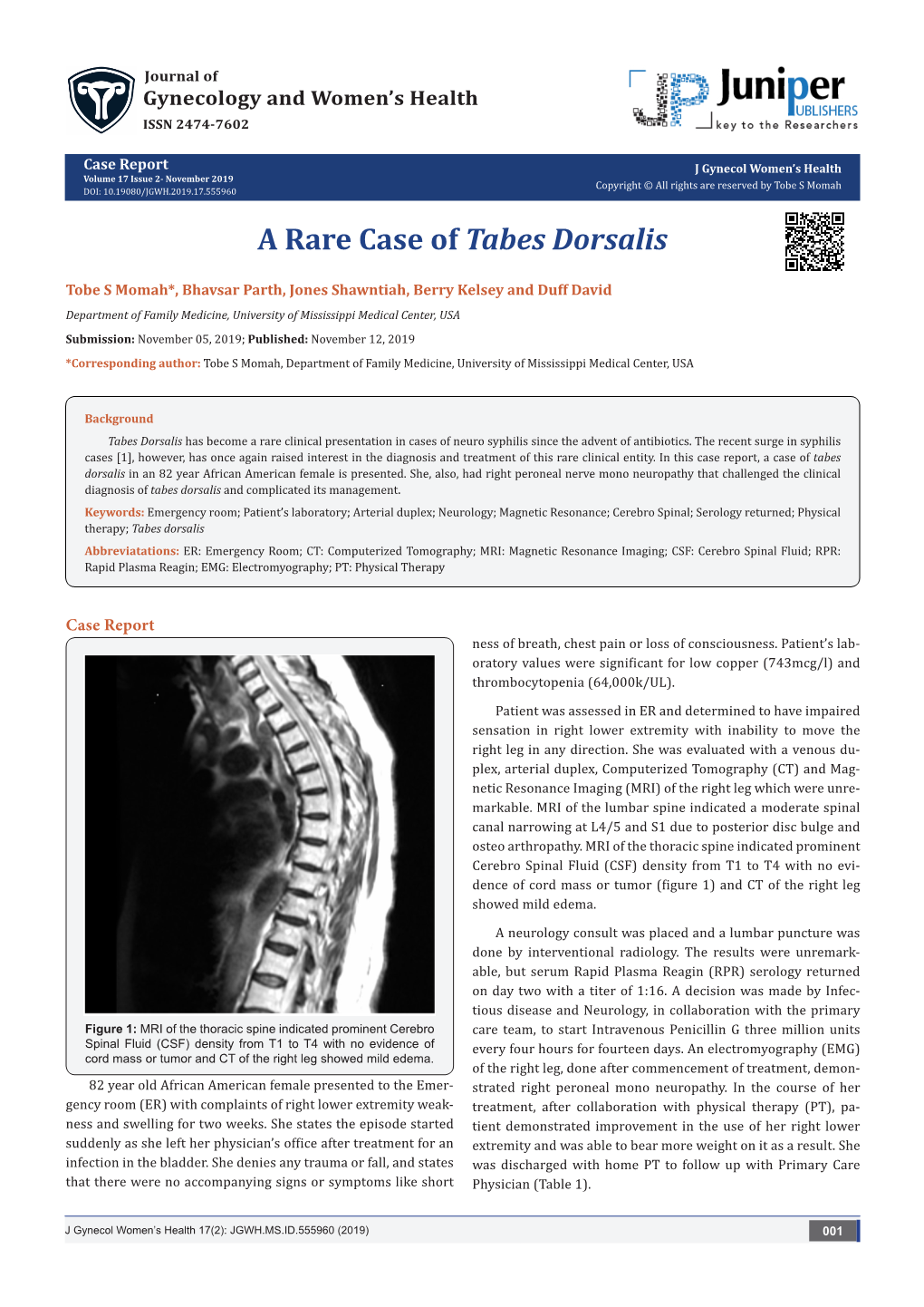 A Rare Case of Tabes Dorsalis