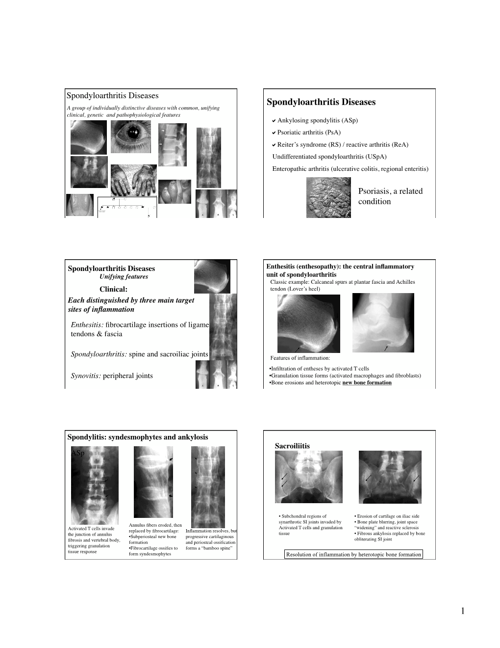 Spondyloarthritis Diseases