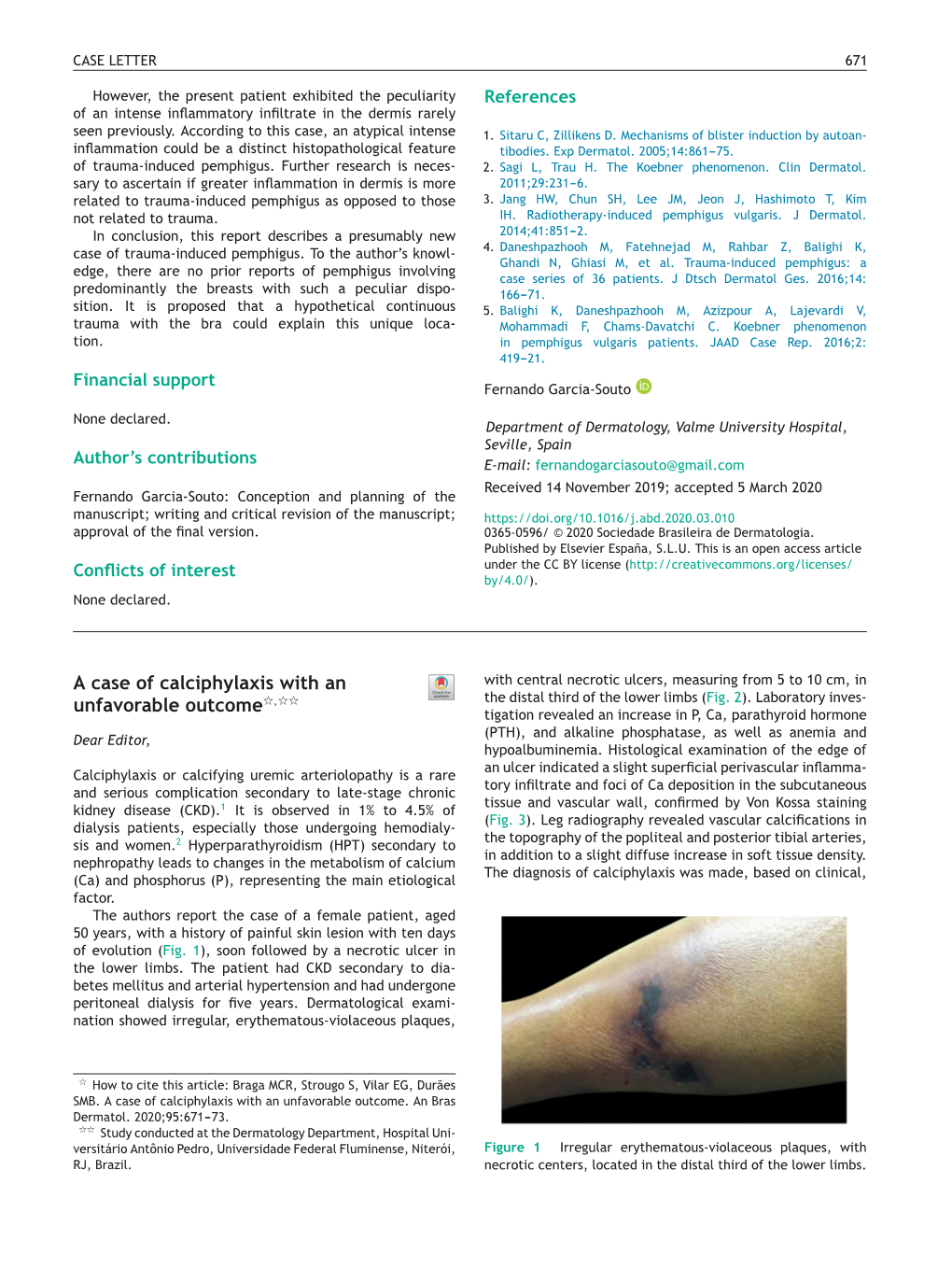 A Case of Calciphylaxis with an Unfavorable Outcome