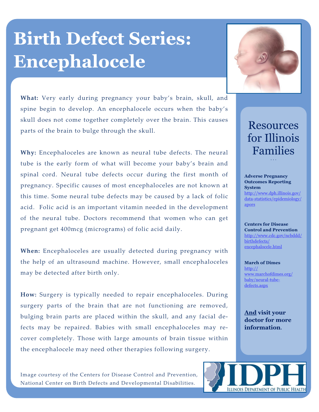 Birth Defect Series: Encephalocele