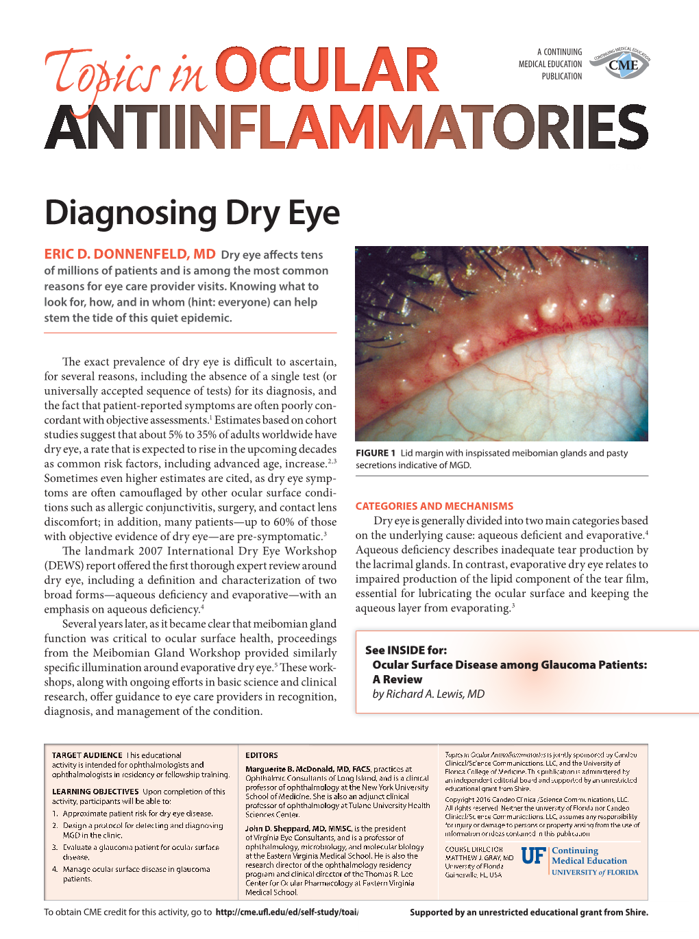 Diagnosing Dry Eye