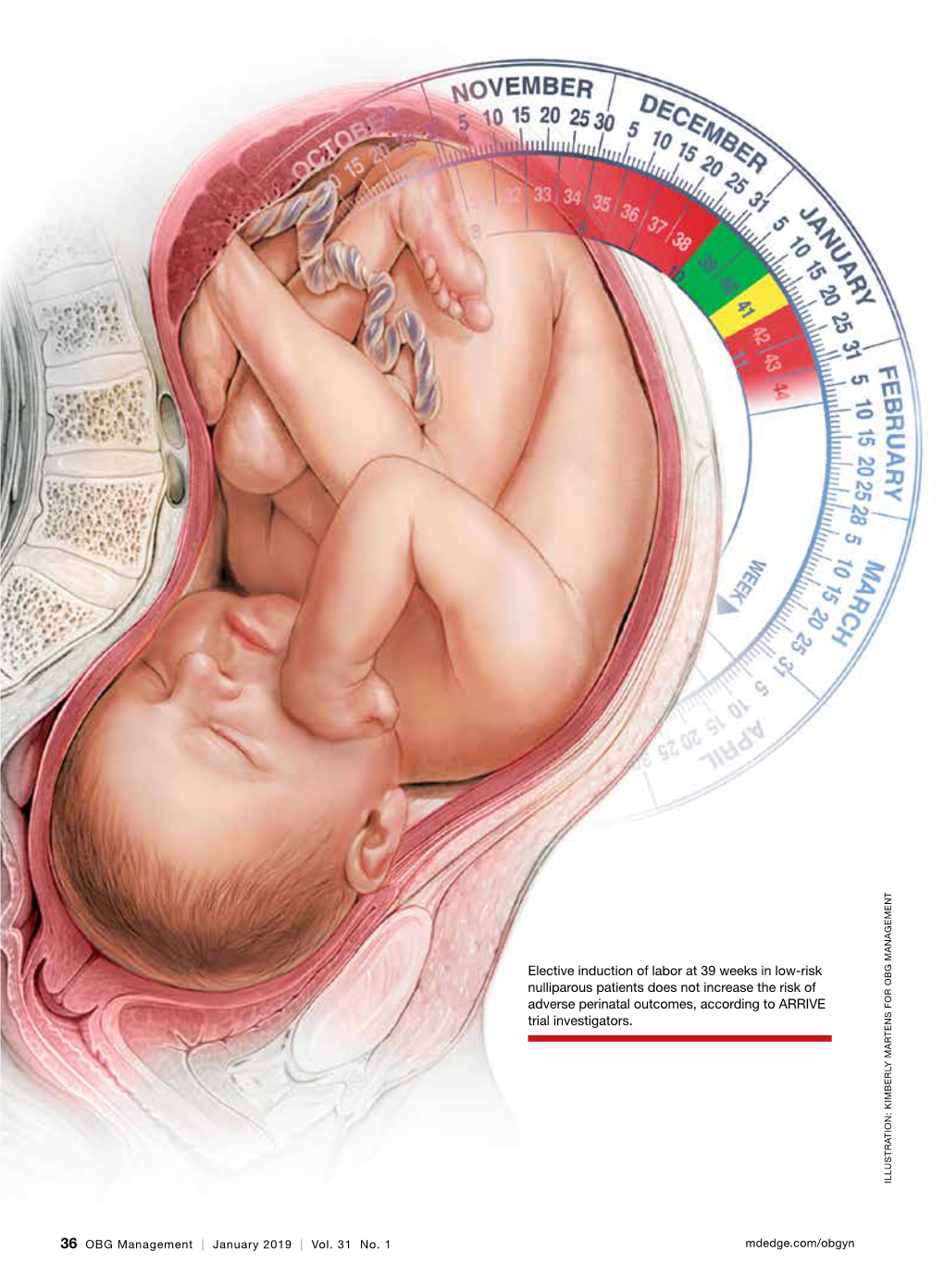 Elective Induction of Labor at 39 Weeks in Low-Risk Nulliparous Patients Does Not Increase the Risk of Adverse Perinatal Outcome