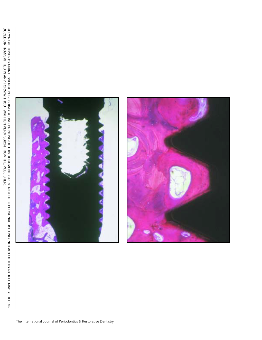 The International Journal of Periodontics & Restorative Dentistry