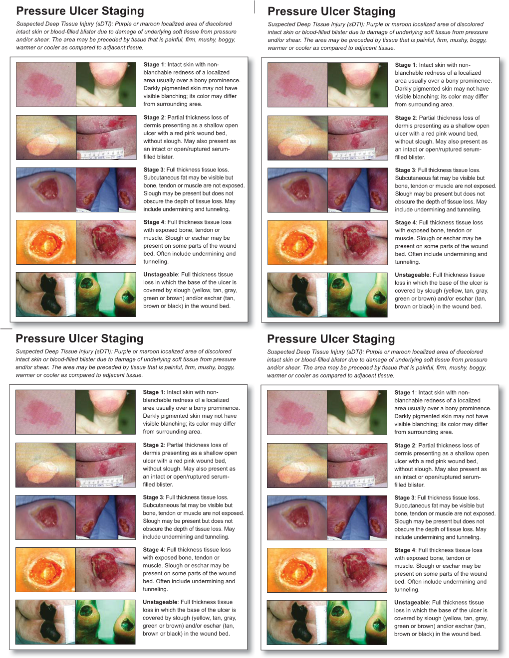 Pressure Ulcer Staging Cards and Skin Inspection Opportunities.Indd