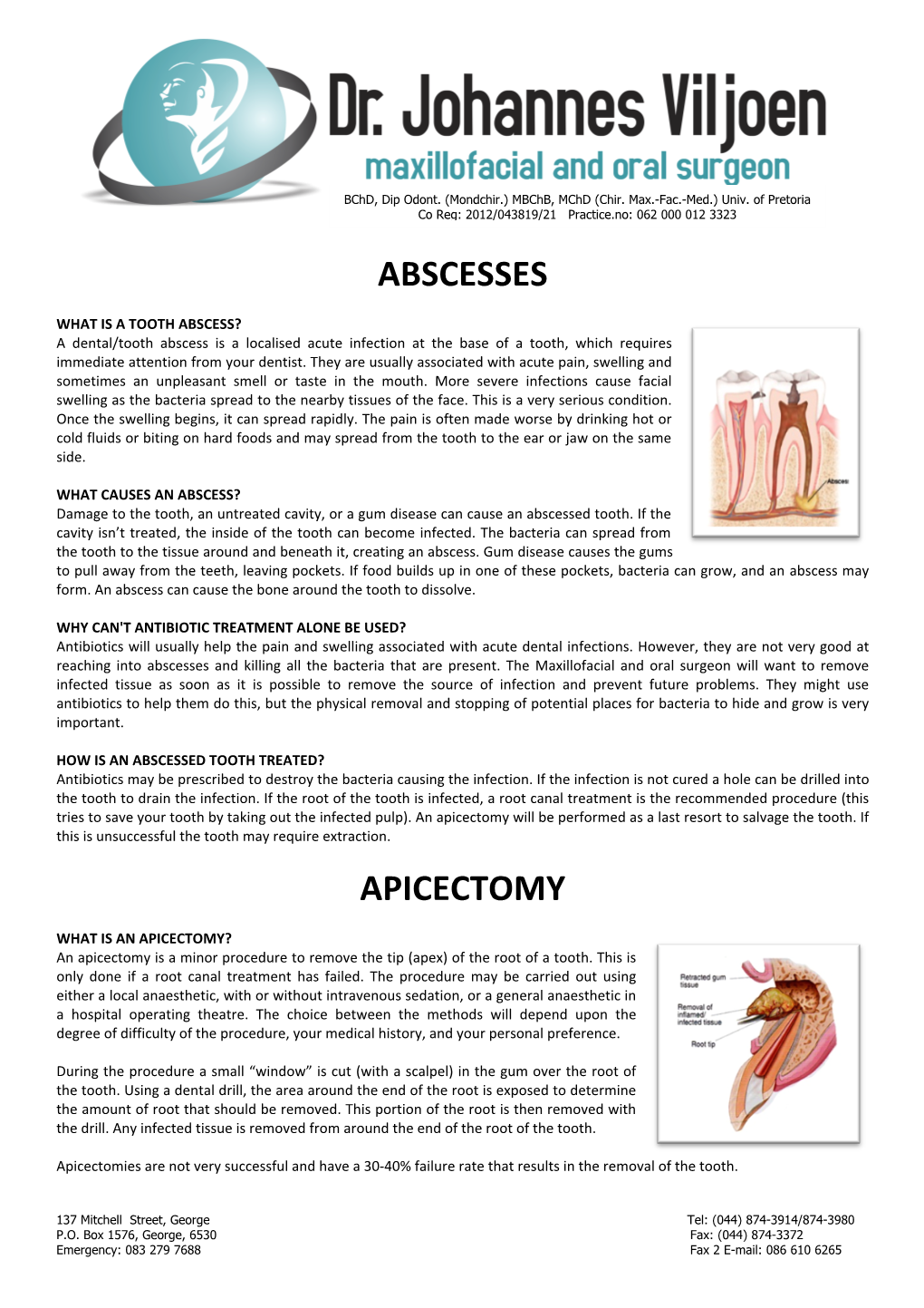 Abscesses Apicectomy