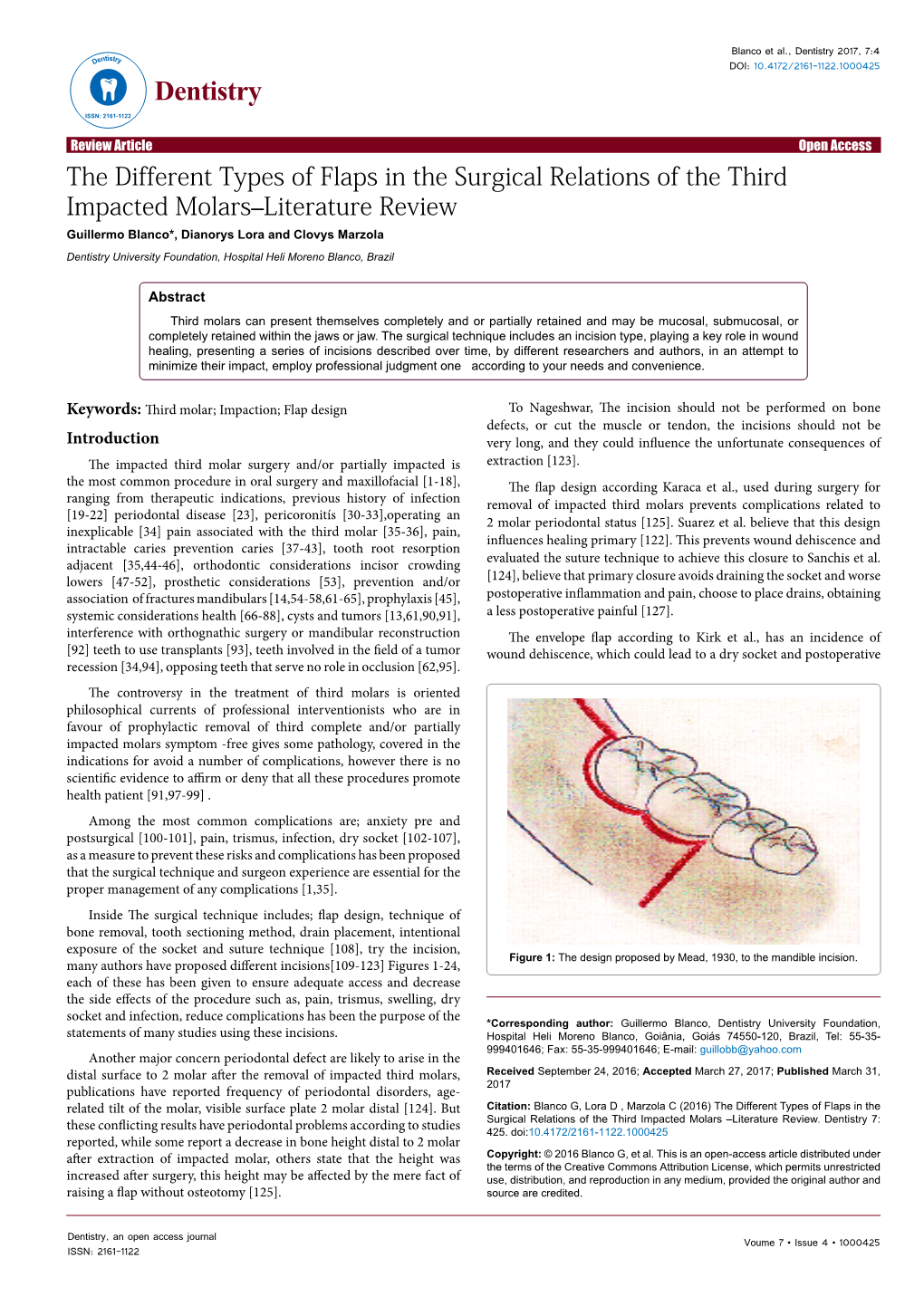 The Different Types of Flaps in the Surgical Relations of the Third