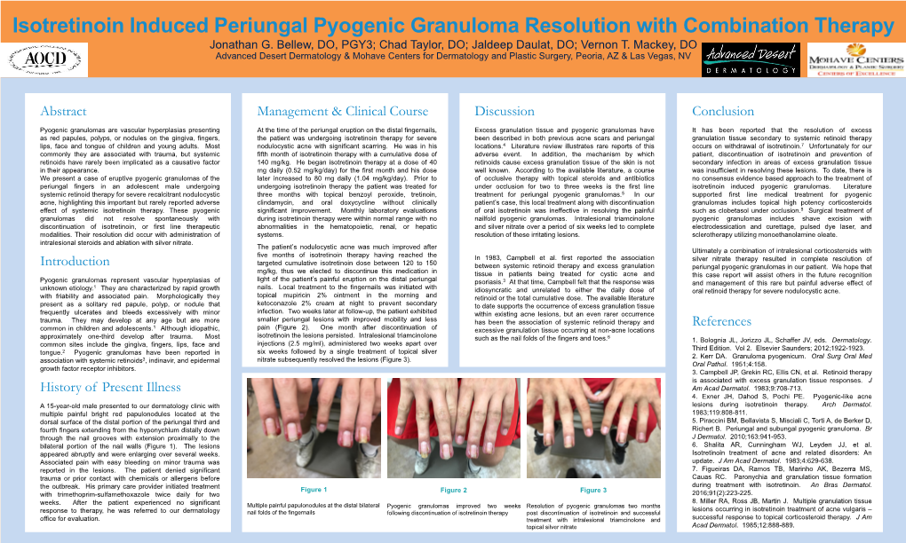 Isotretinoin Induced Periungal Pyogenic Granuloma Resolution with Combination Therapy Jonathan G