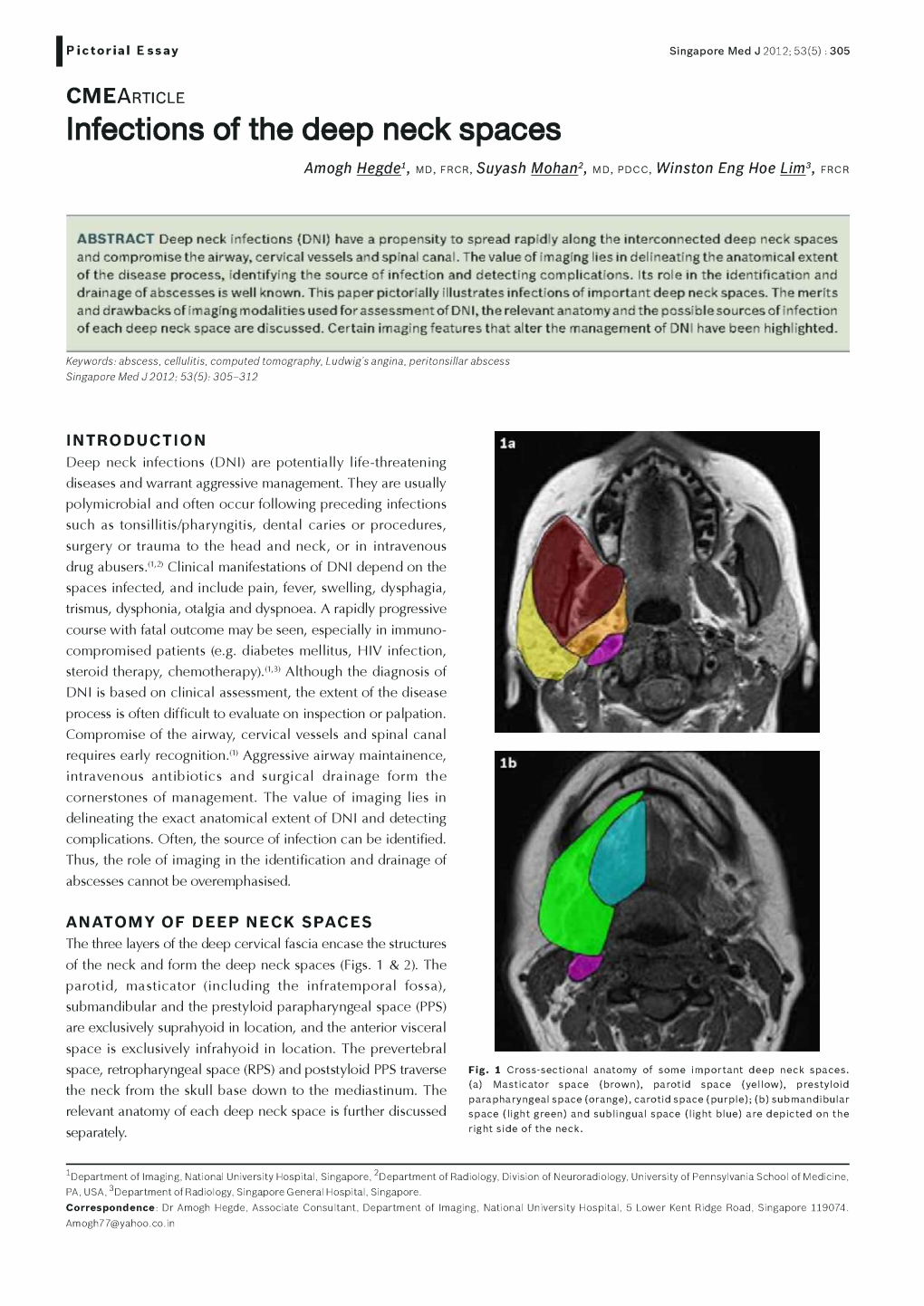 Infections of the Deep Neck Spaces