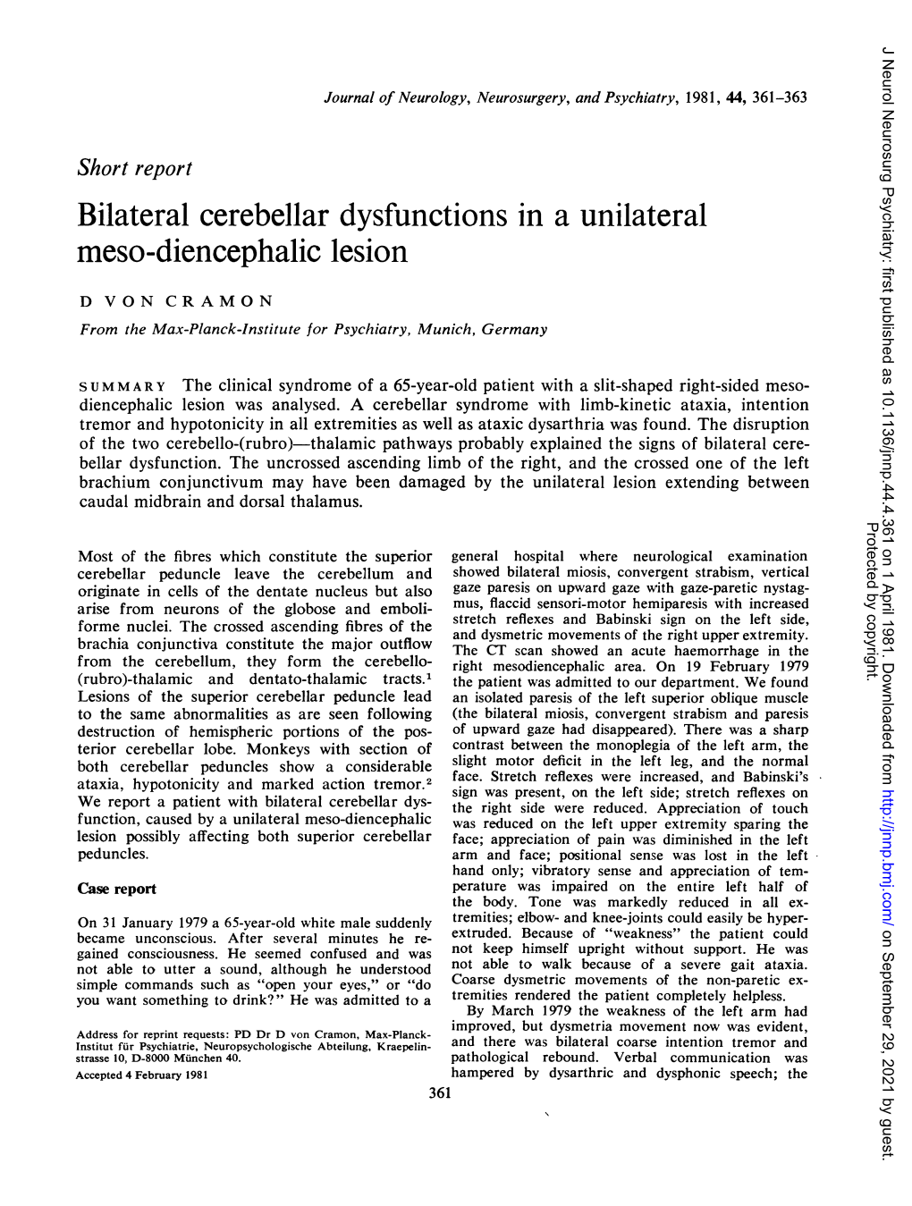 Bilateral Cerebellar Dysfunctions in a Unilateral Meso-Diencephalic Lesion