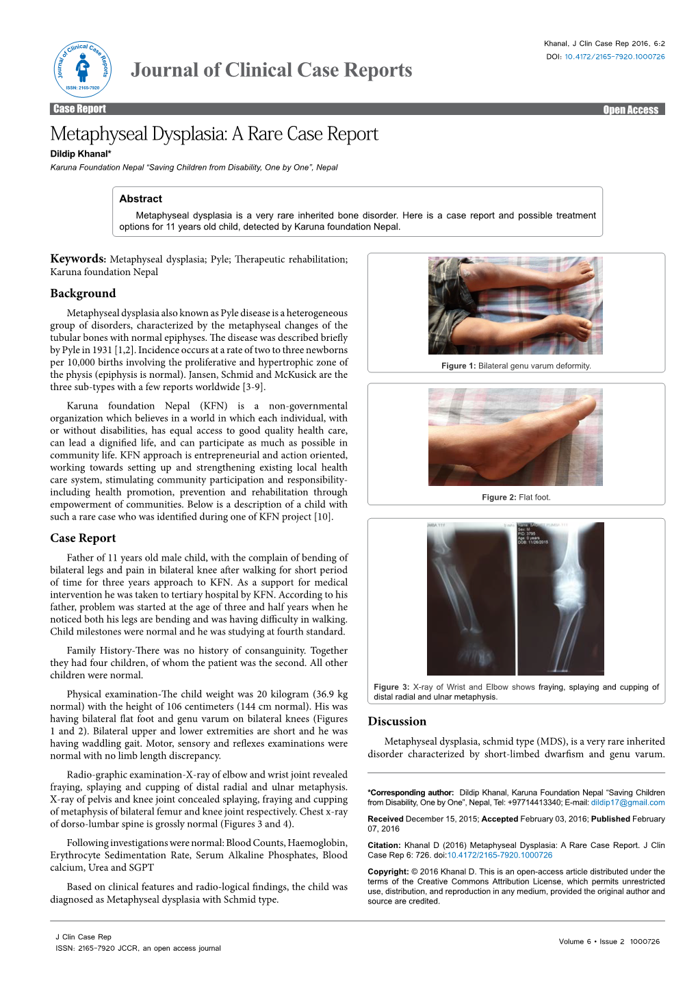 Metaphyseal Dysplasia: a Rare Case Report Dildip Khanal* Karuna Foundation Nepal “Saving Children from Disability, One by One”, Nepal