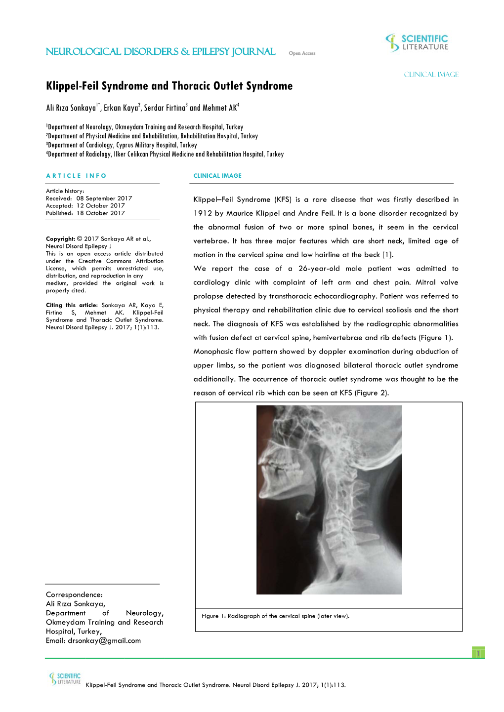 Klippel-Feil Syndrome and Thoracic Outlet Syndrome