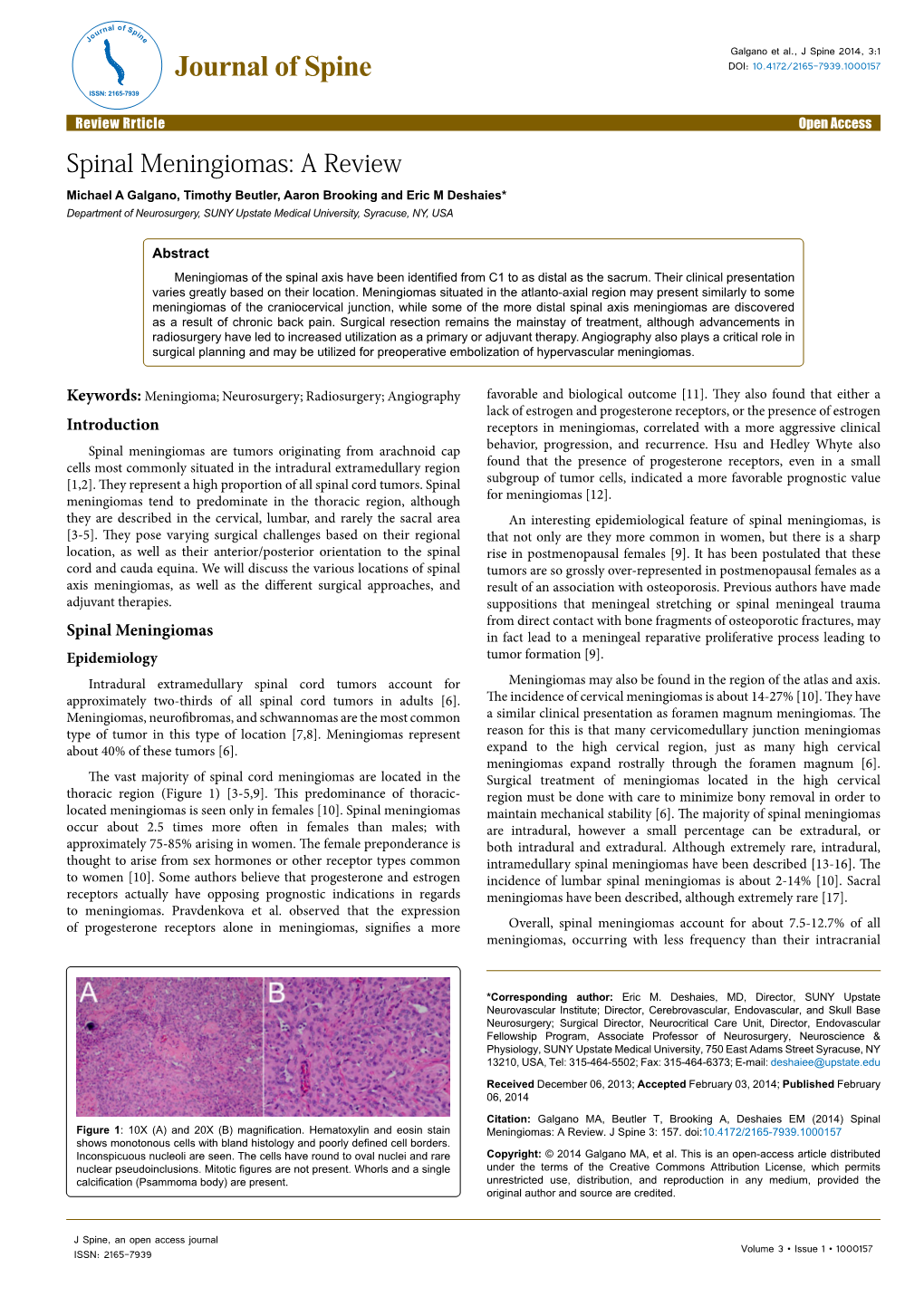 Spinal Meningiomas: a Review