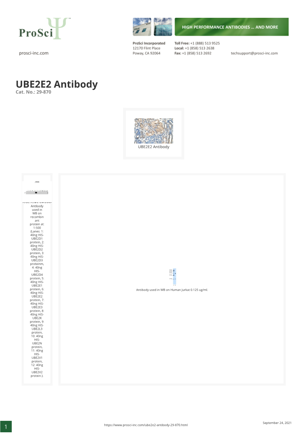 UBE2E2 Antibody Cat