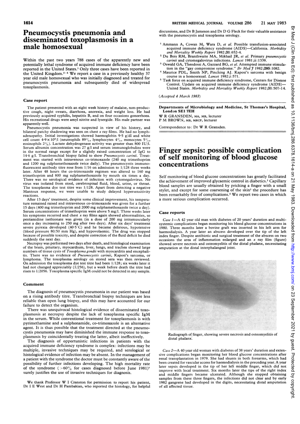 Pneumocystis Pneumonia and Disseminated