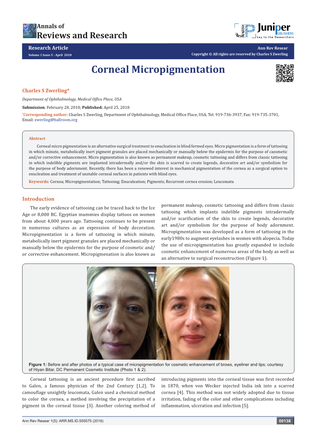 Corneal Micropigmentation