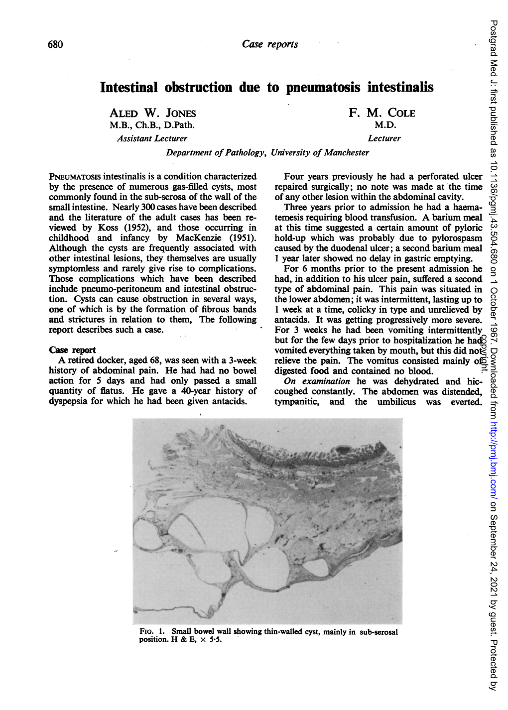 Intestinal Obstruction Due to Pneumatosis Intestinalis ALED W