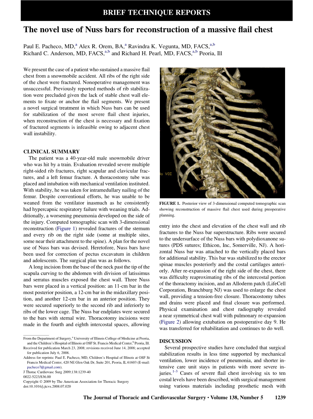 The Novel Use of Nuss Bars for Reconstruction of a Massive Flail Chest