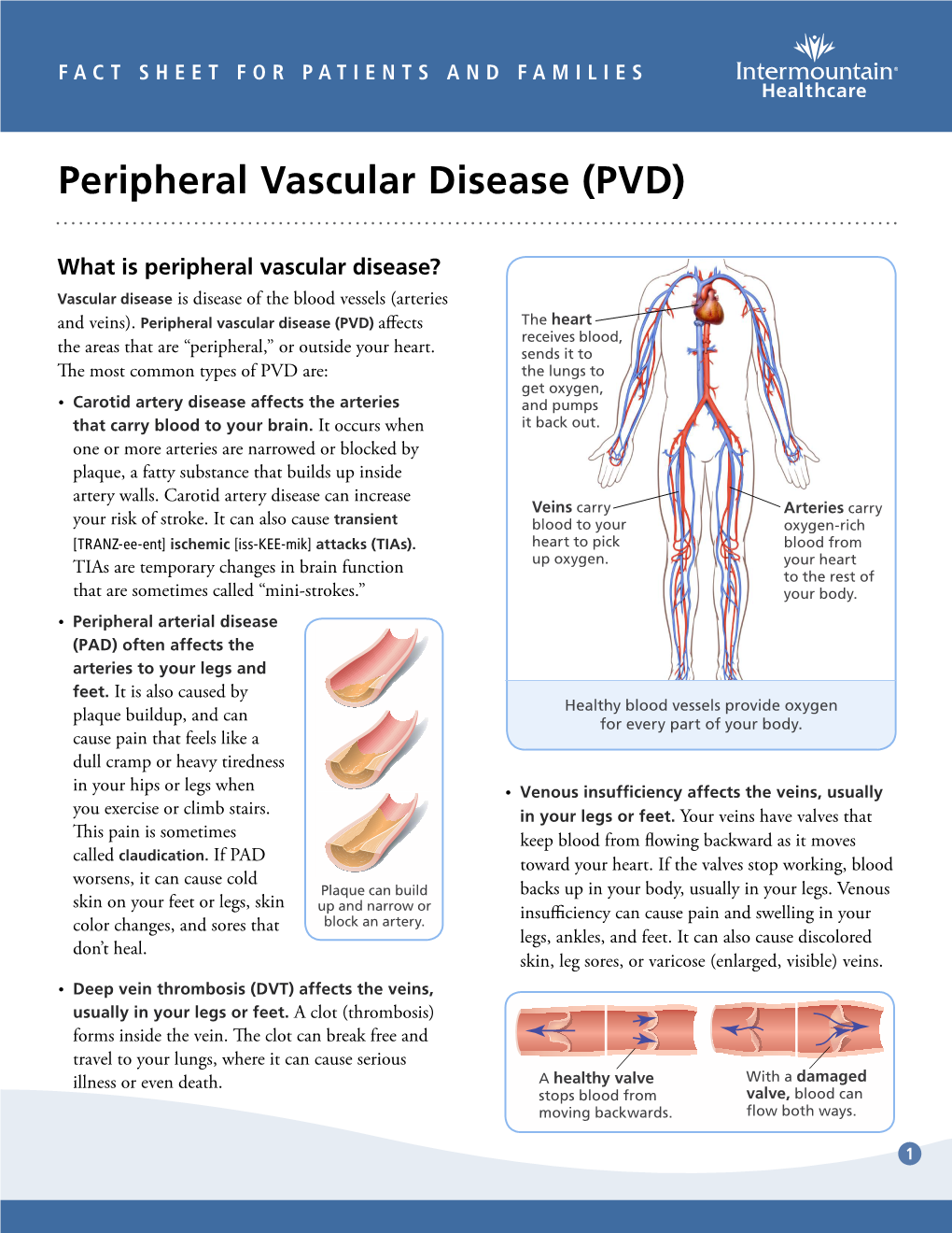 Peripheral Vascular Disease (PVD) Fact Sheet