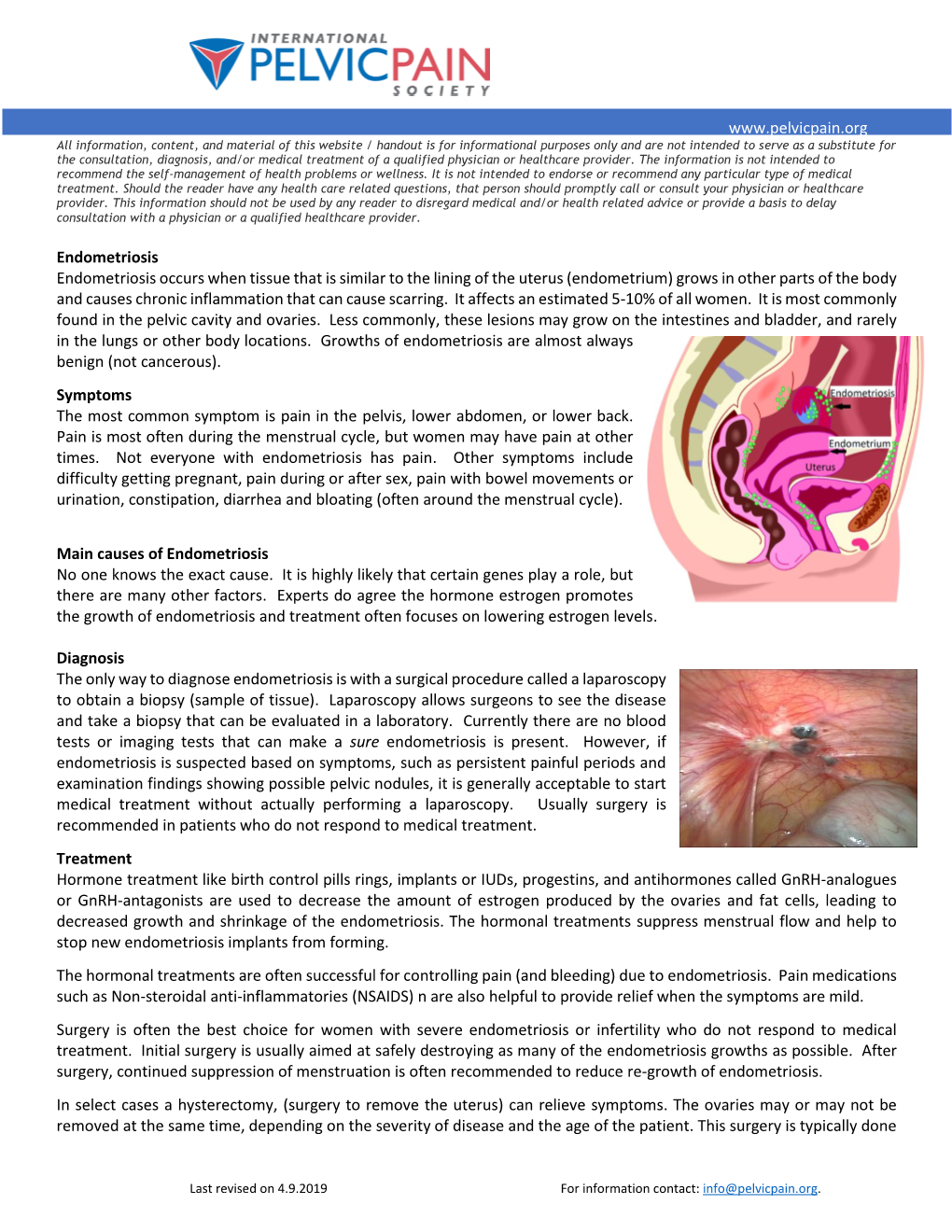 Endometriosis