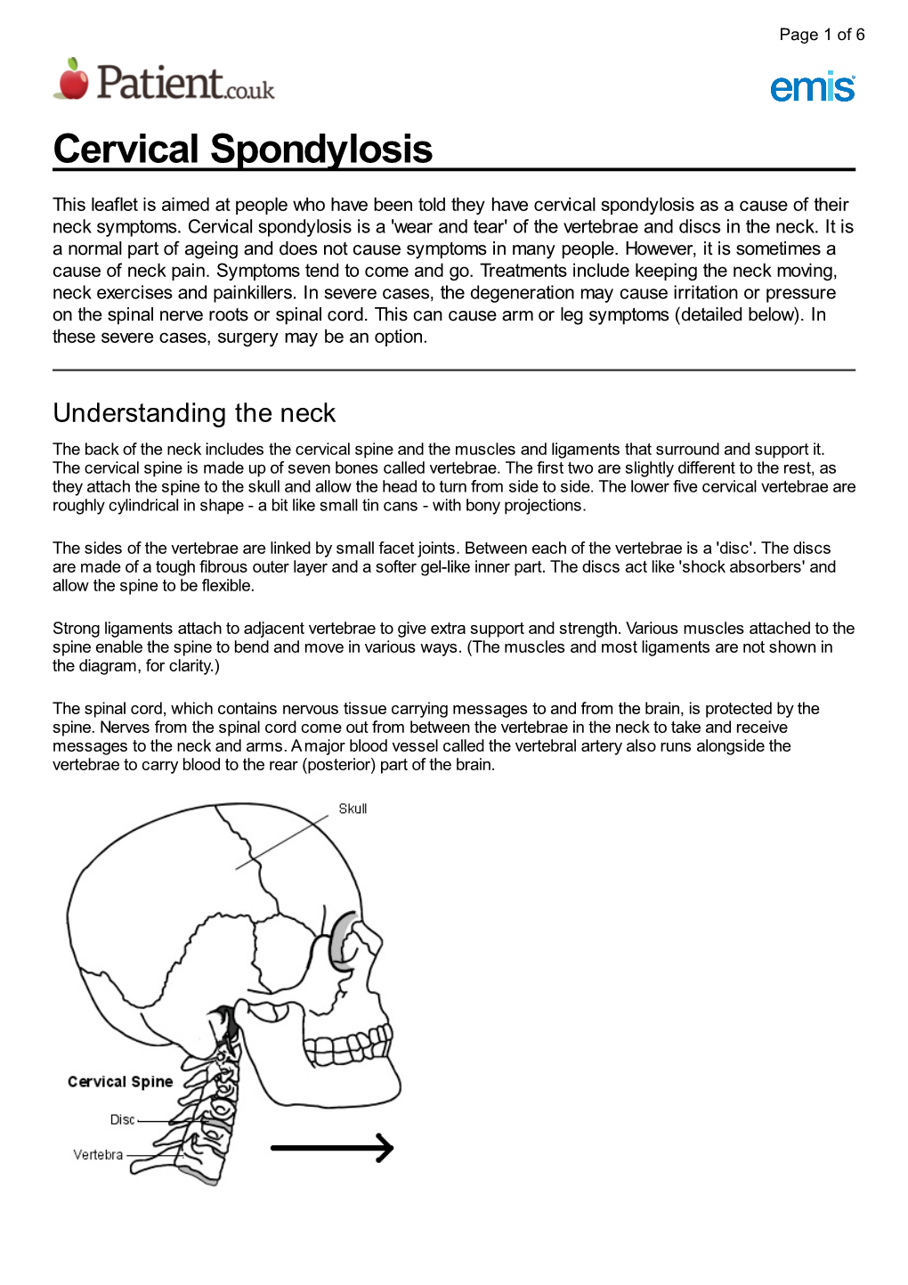 Cervical Spondylosis