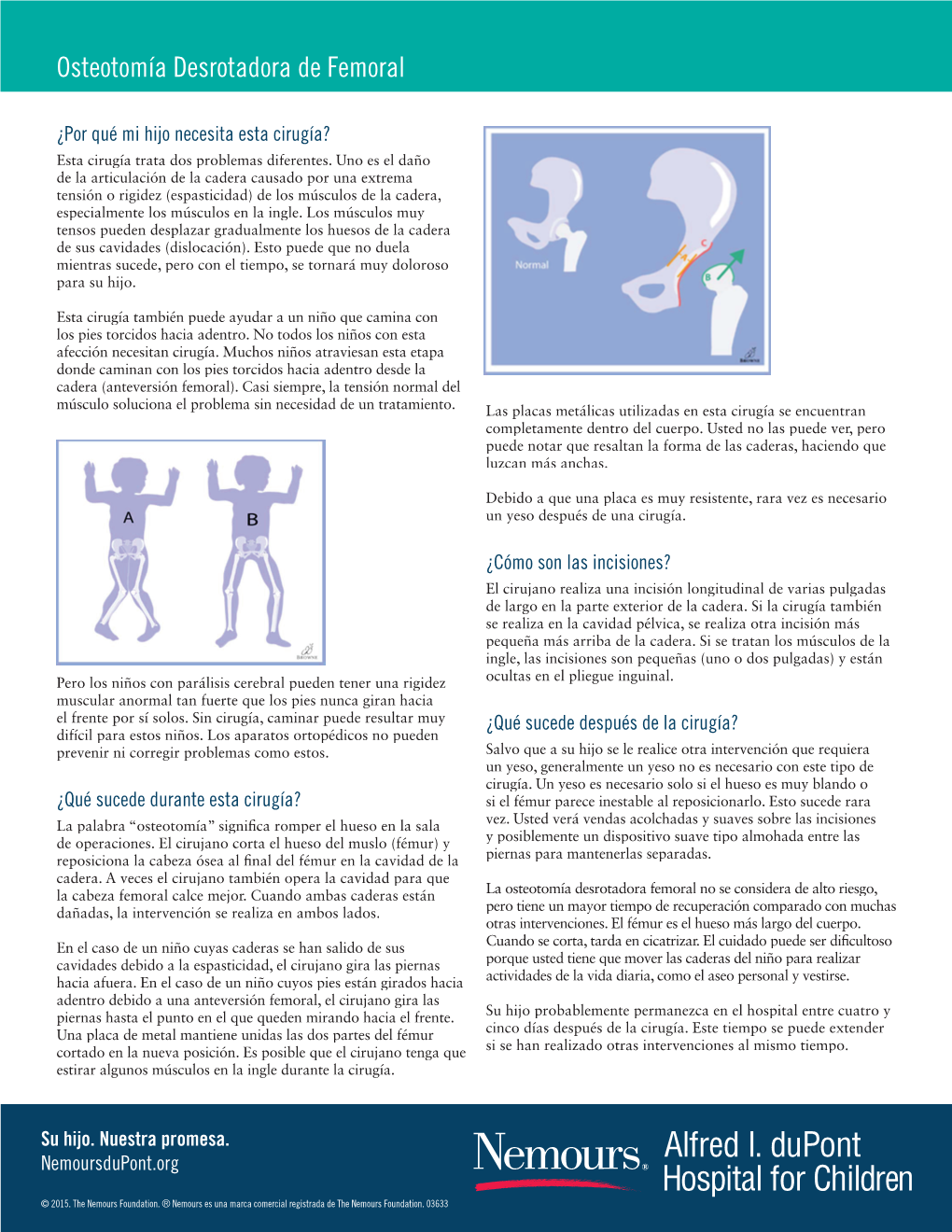 Osteotomía Desrotadora De Femoral