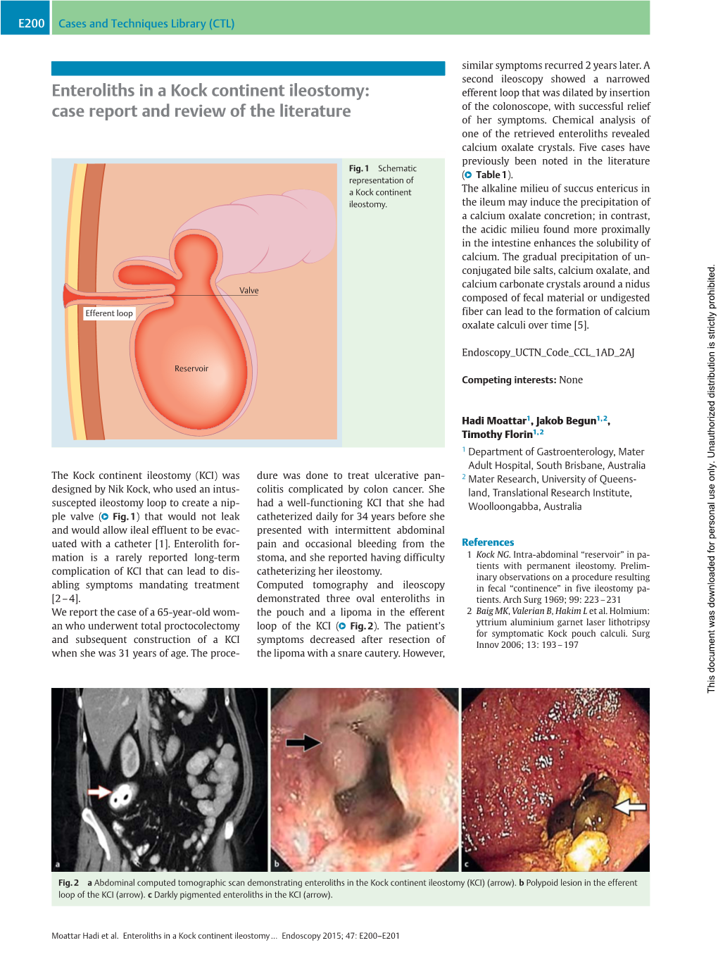 Enteroliths in a Kock Continent Ileostomy: Case Report and Review of the Literature