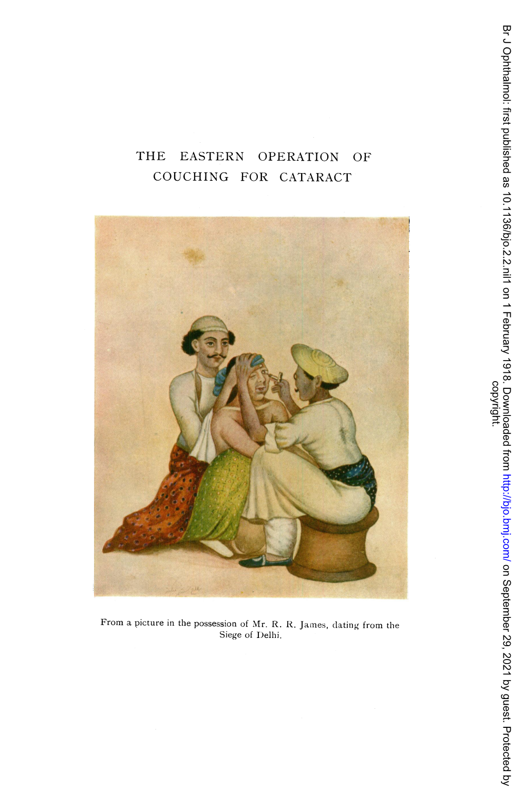 THE EASTERN OPERATION of COUCHING for CATARACT Copyright