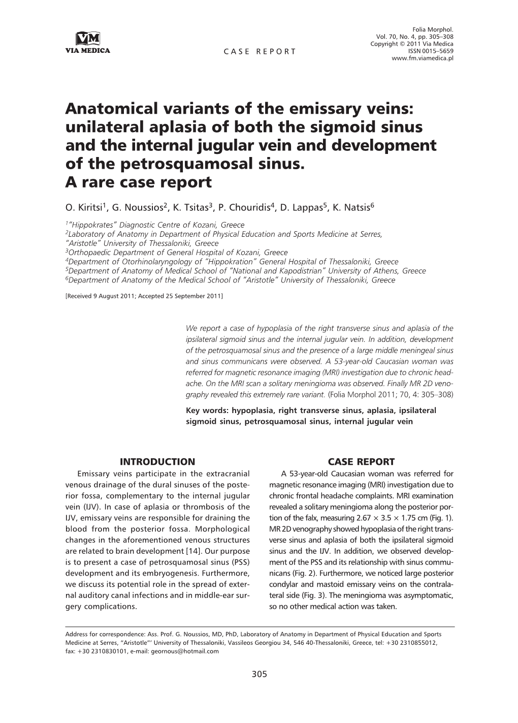 Anatomical Variants of the Emissary Veins: Unilateral Aplasia of Both the Sigmoid Sinus and the Internal Jugular Vein and Development of the Petrosquamosal Sinus