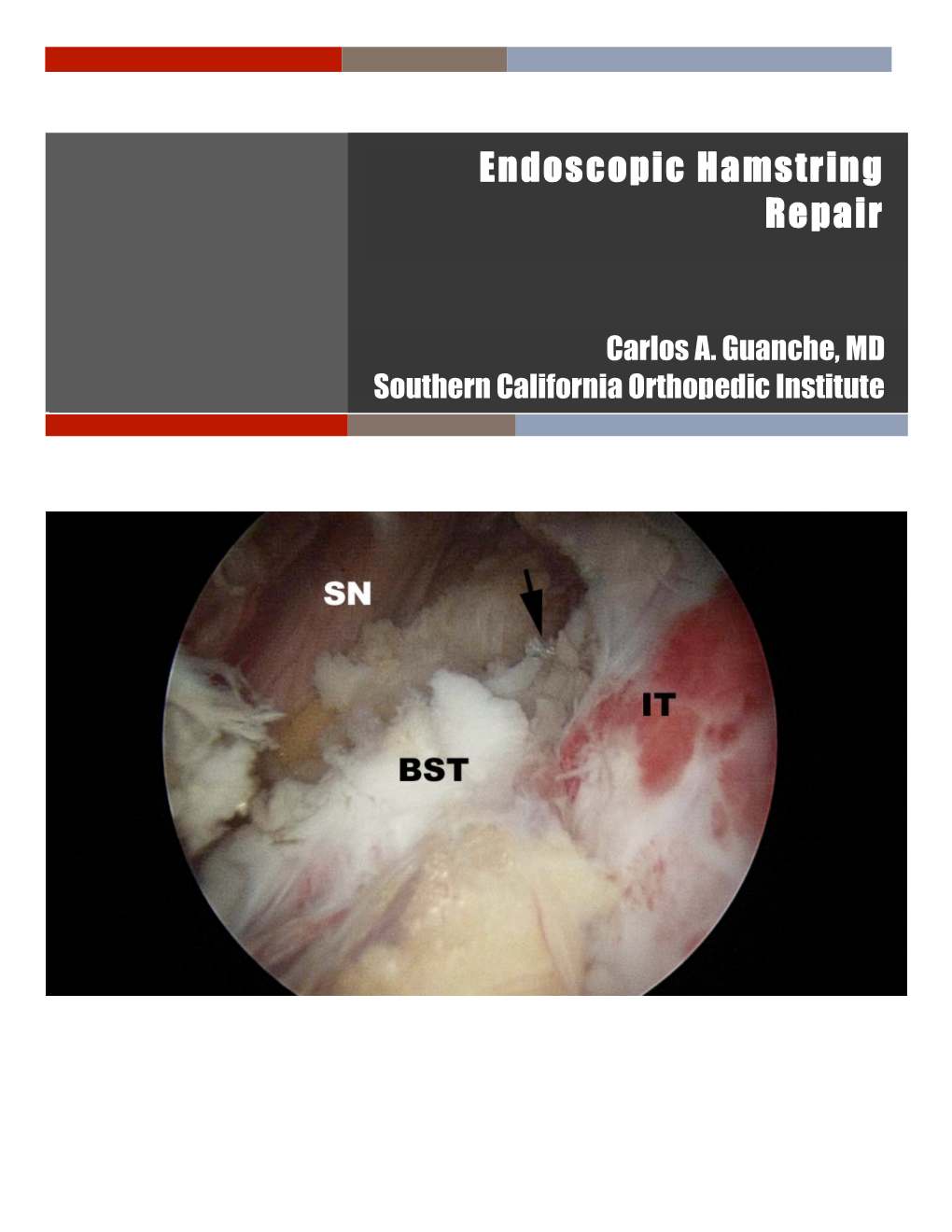 Endoscopic Hamstring Repair