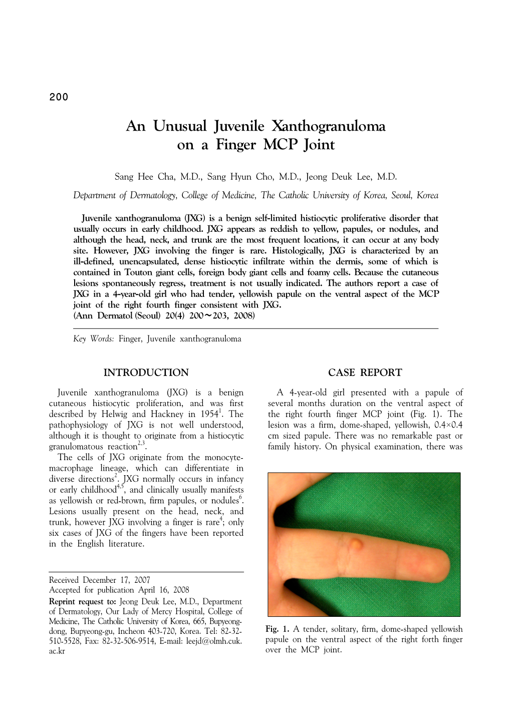 An Unusual Juvenile Xanthogranuloma on a Finger MCP Joint