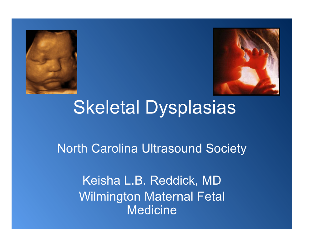 Skeletal Dysplasias