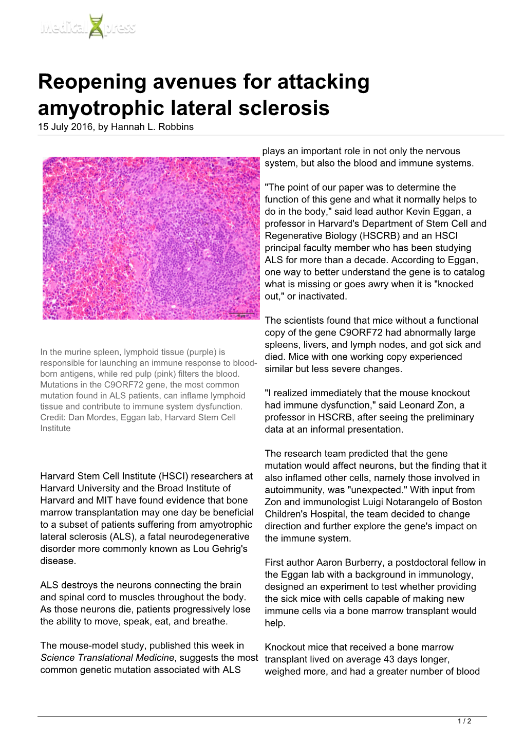 Reopening Avenues for Attacking Amyotrophic Lateral Sclerosis 15 July 2016, by Hannah L