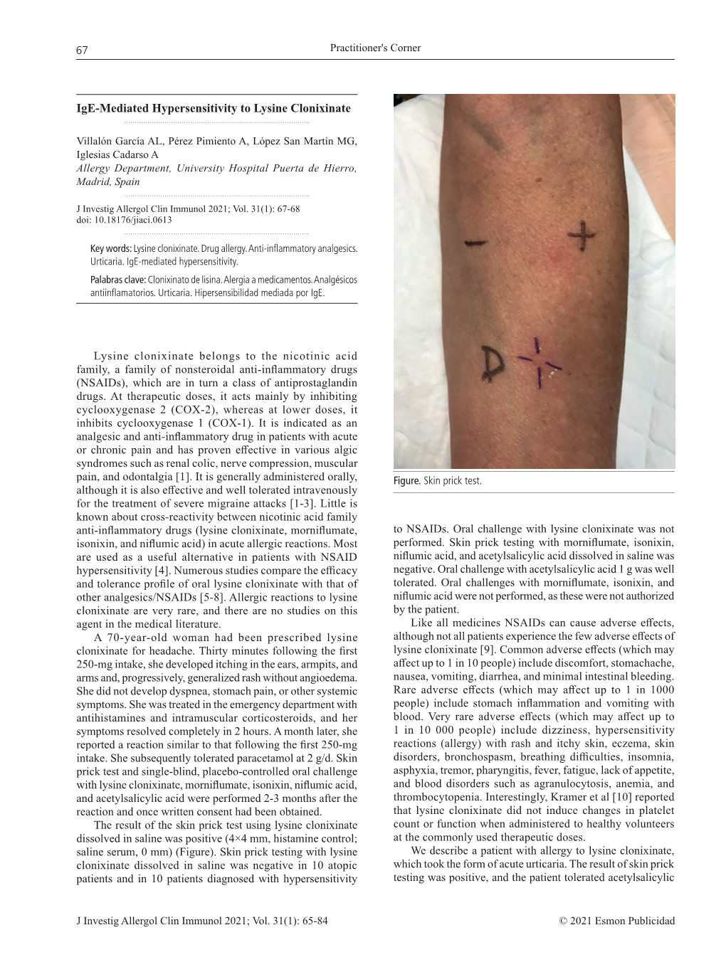 Ige-Mediated Hypersensitivity to Lysine Clonixinate