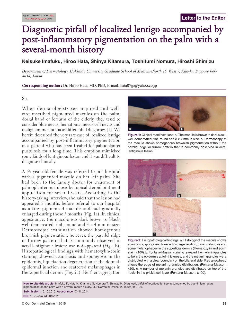 Diagnostic Pitfall of Localized Lentigo Accompanied by Post-Inflammatory