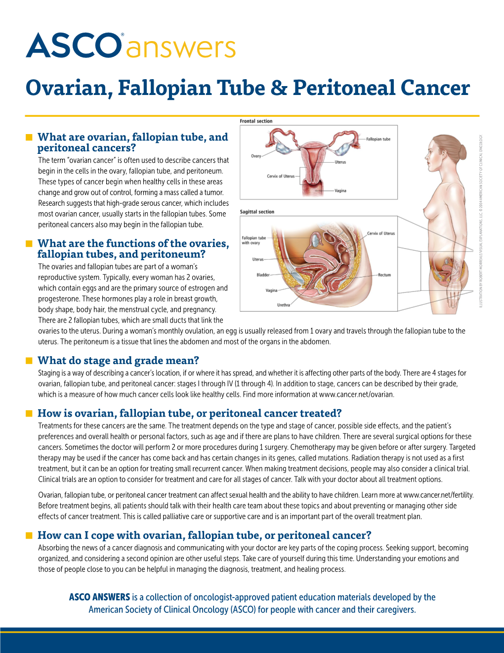 ASCO Answers: Ovarian, Fallopian Tube, and Peritoneal Cancer