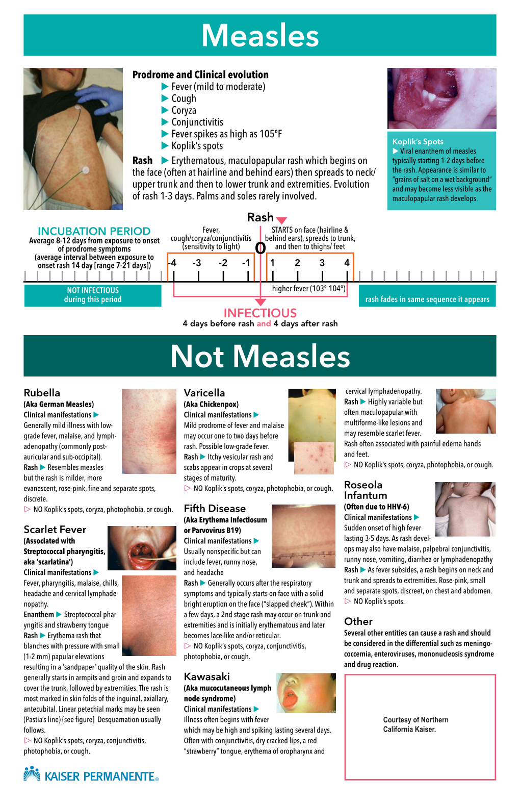 Measles Diagnostic Tool