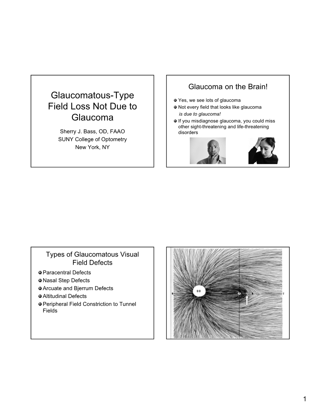 Bass – Glaucomatous-Type Field Loss Not Due to Glaucoma