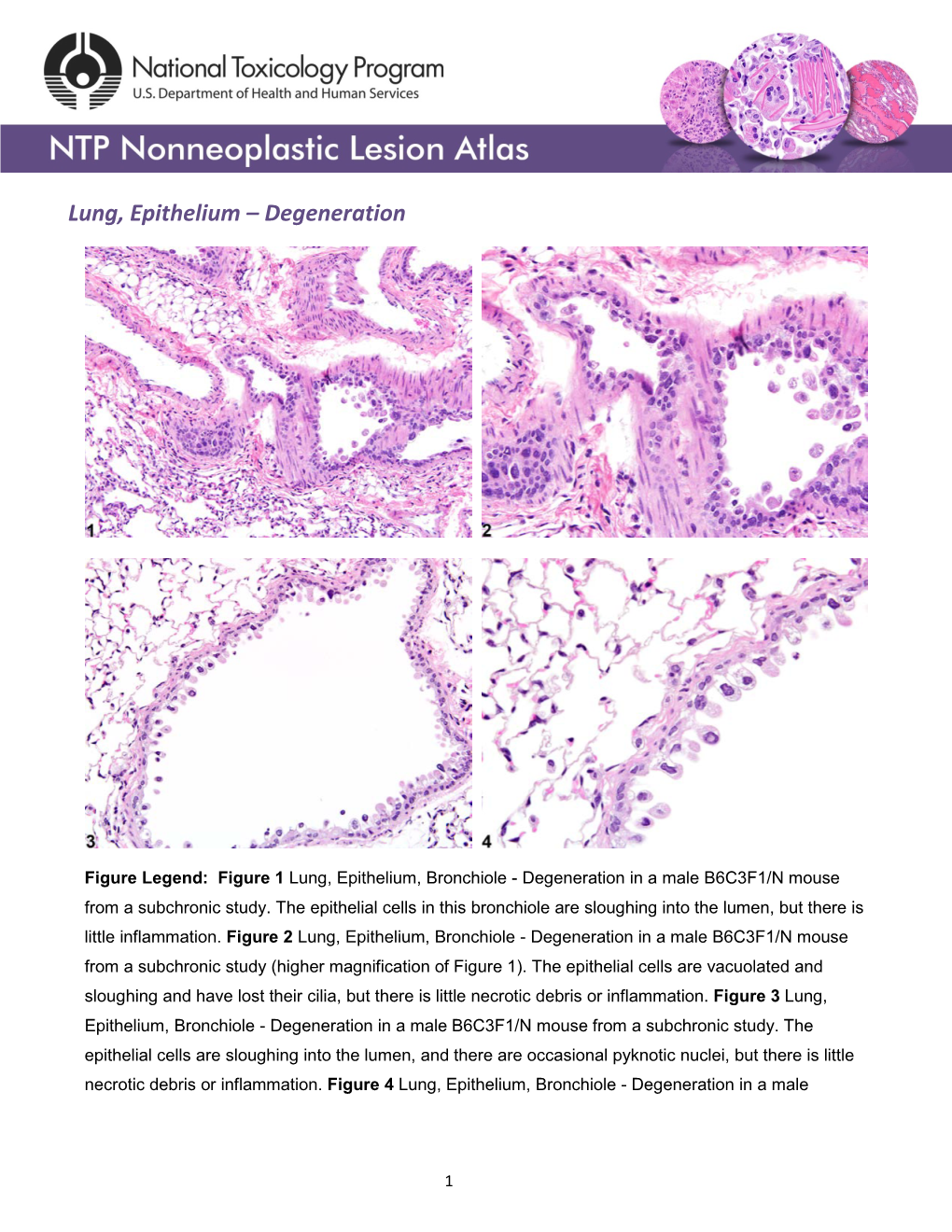 Lung, Epithelium – Degeneration