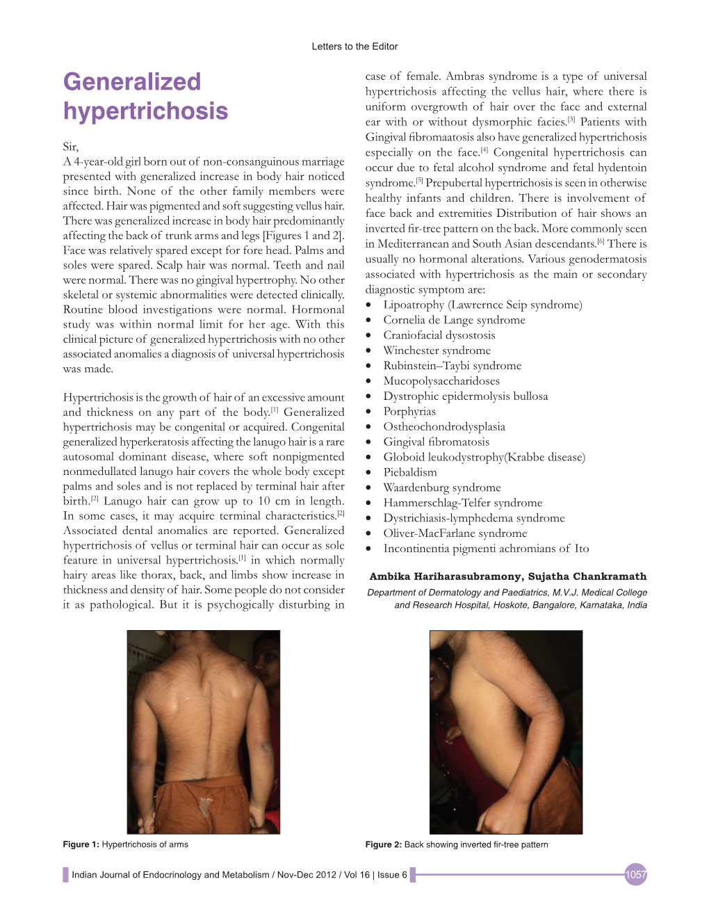 Generalized Hypertrichosis