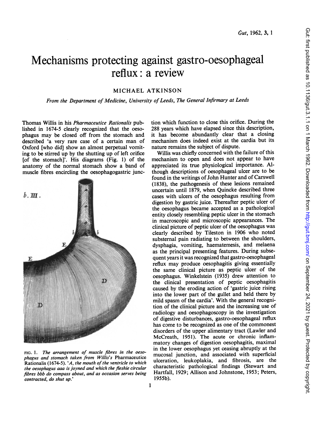 Mechanisms Protecting Against Gastro-Oesophageal Reflux: a Review