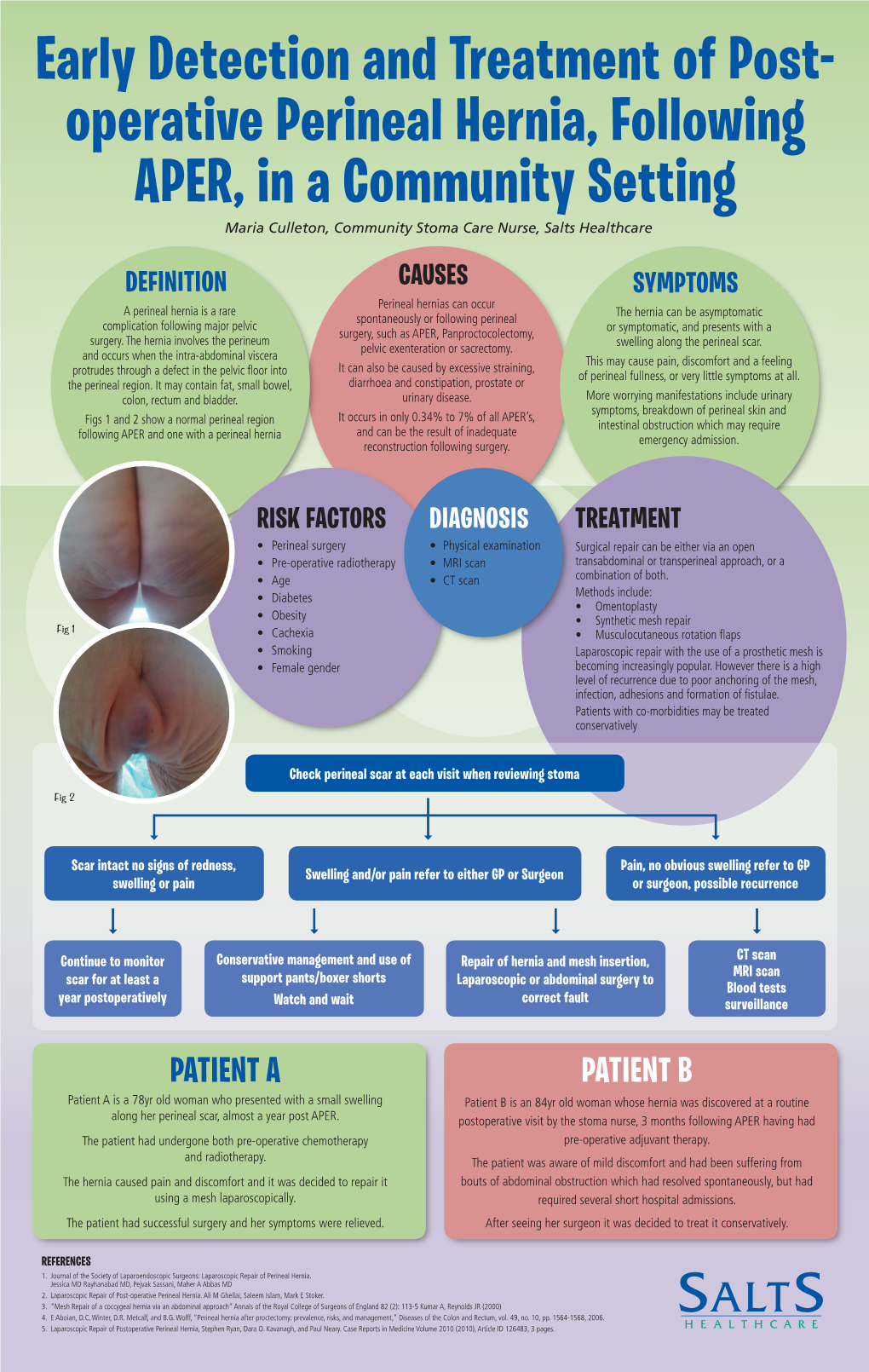 Operative Perineal Hernia, Following APER, in a Community Setting Maria Culleton, Community Stoma Care Nurse, Salts Healthcare