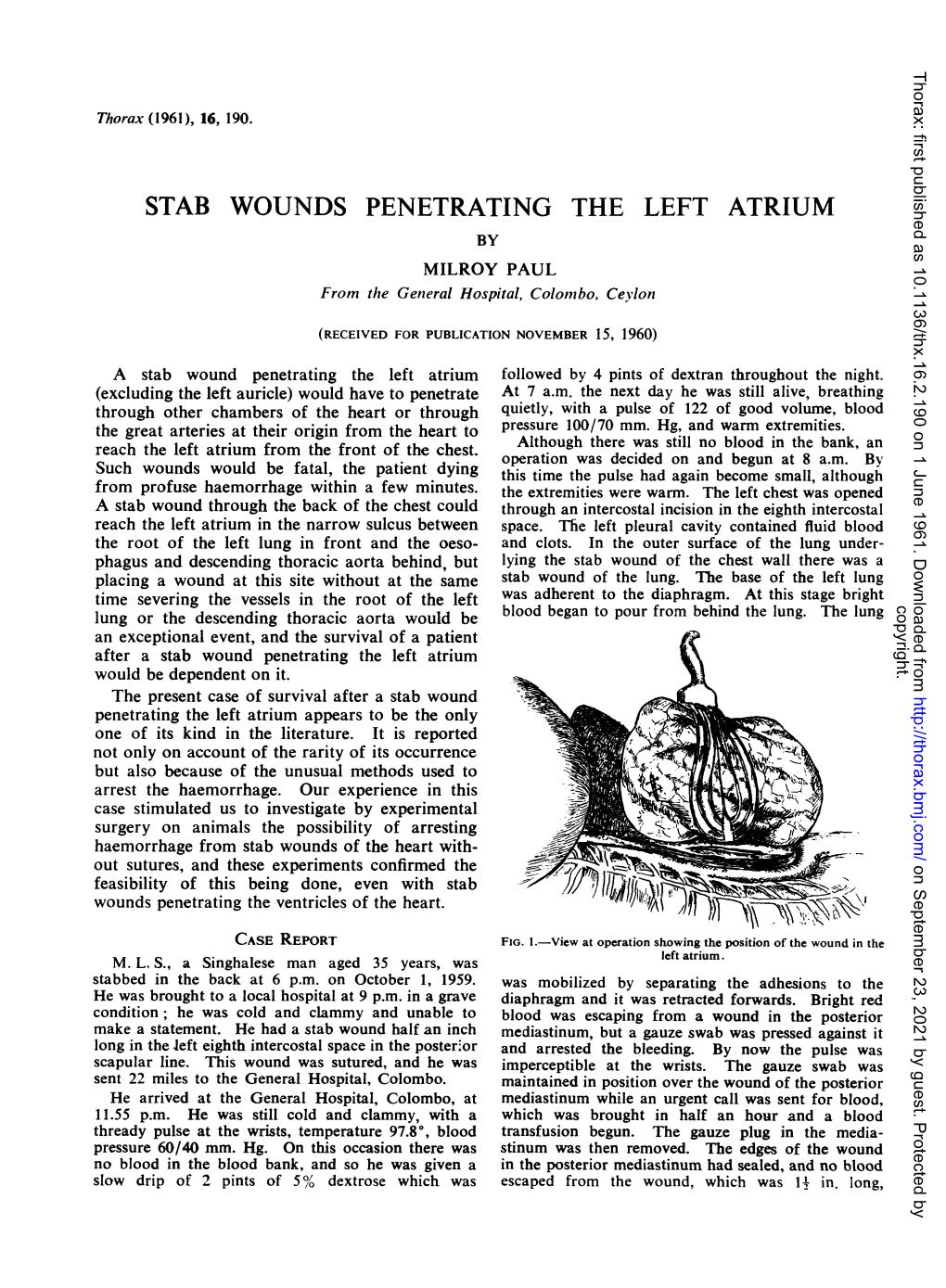 STAB WOUNDS PENETRATING the LEFT ATRIUM by MILROY PAUL from the General Hospital, Colombo, Ceylon