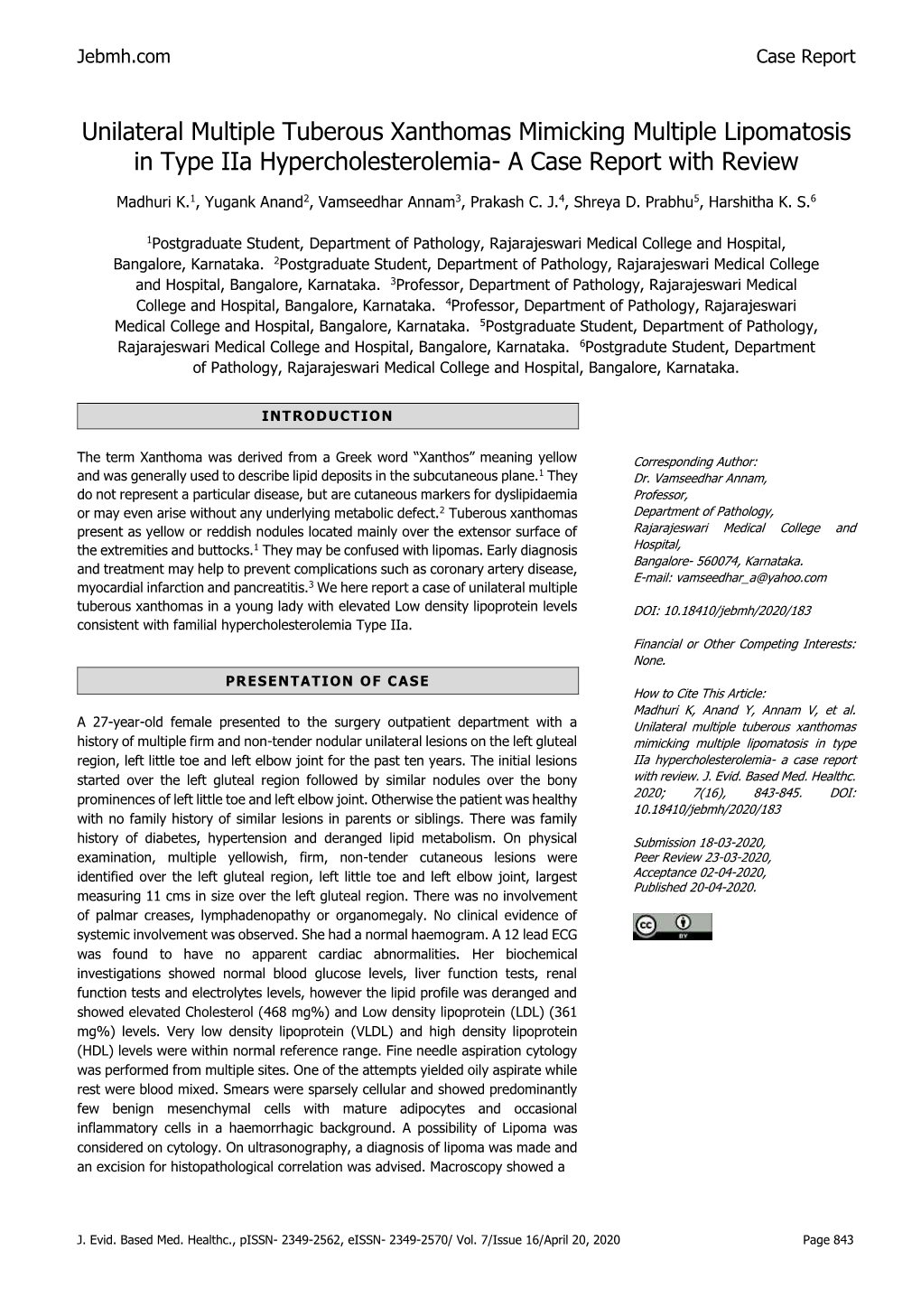 Unilateral Multiple Tuberous Xanthomas Mimicking Multiple Lipomatosis in Type Iia Hypercholesterolemia- a Case Report with Review